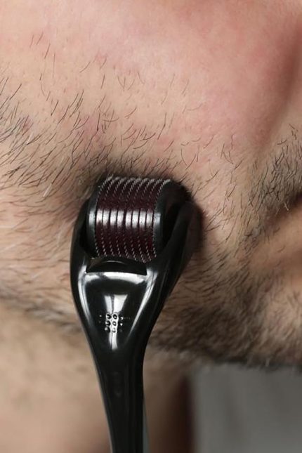 Uçlu Dermaroller Iğneli Sakal Saç Yenileyici Cilt Yüz Vücut Yenileme Masaj Aleti 0.50Mm