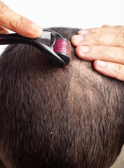 Uçlu Saç Sakal Çıkarma Tarağı Iğneli Cilt Yenileyici Gözenek Açıcı Dermaroller 0,75Mm