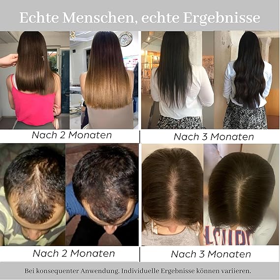 HAIR Yoğunlaşma nane Saç Oluşumuna Yardımcı Saç Serumu Dökülme Karşıtı - Biotin, Keratin, Peptid, Procapil Saç Vitamini Kompleksi, Diamond Hair - Görsel 2
